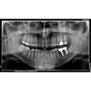 190505_image2.png