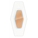 152017_image2.png
