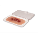 Moulage de plaie Ulcus Cruris Venosum, petit, phase d'exsudation