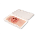 Moulage de plaie décubitus sacré, nettoyée