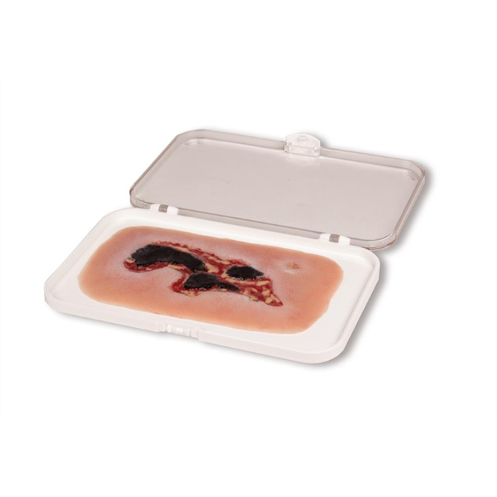 [PW004A] Moulage de plaie ulcère de jambe veineux, petit, phase d'épithélisation