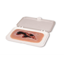 Moulage de plaie ulcère de jambe veineux, petit, phase d'épithélisation