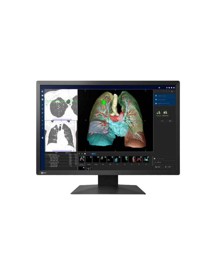 Moniteur médical 24" Noir EIZO - Norme DICOM Part 14
